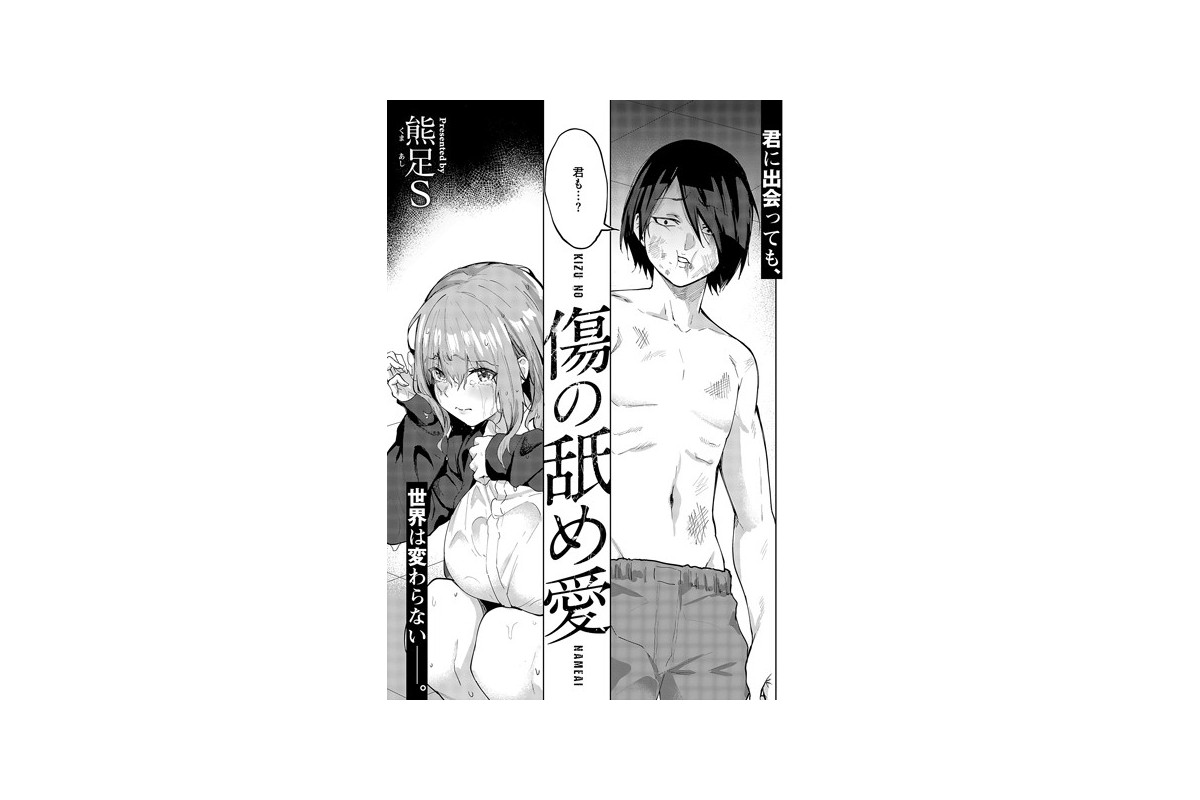 傷の舐め愛｜単話 熊足S レビュー・感想